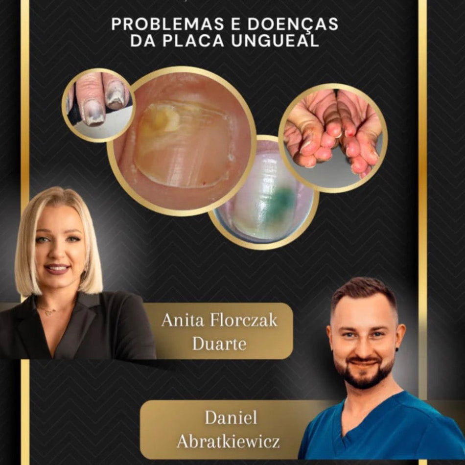 Problemas e Doenças da Placa Ungueal - Soluções Eficazes